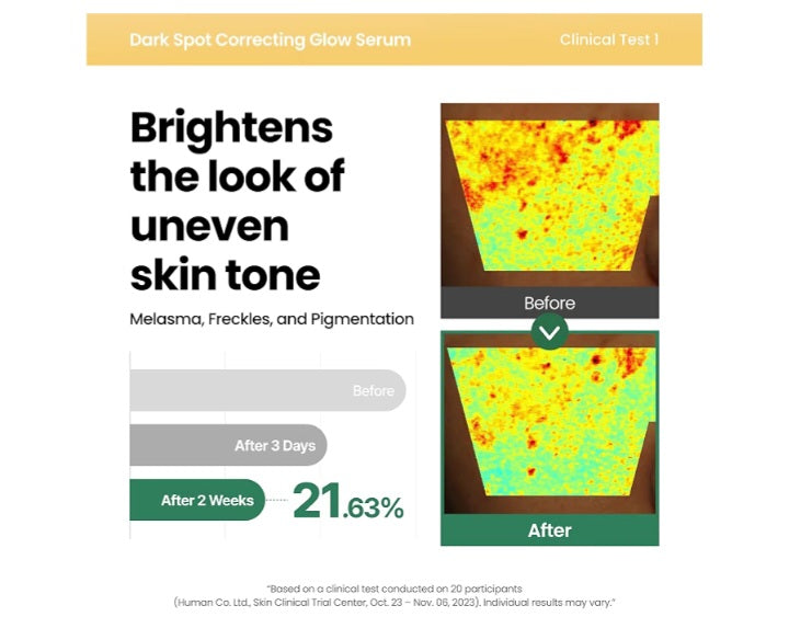 Dark Spot Correction Glow Serum